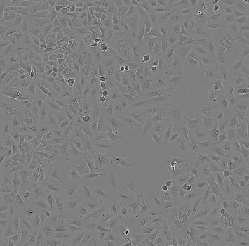 CAL-62人甲状腺癌贴壁细胞系的应用