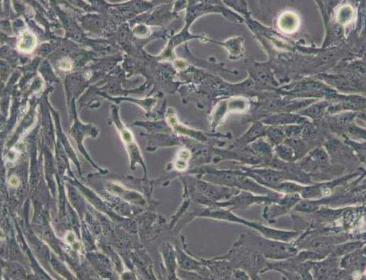 人神经胶质细胞瘤细胞