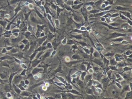 Chondrocytes Cells