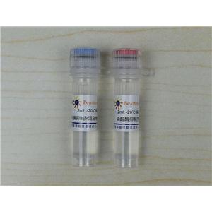 蛋白酶磷酸酶抑制剂混合物(真菌或酵母抽提用, 50X)