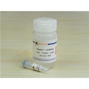 TOP2A  Rabbit Polyclonal Antibody