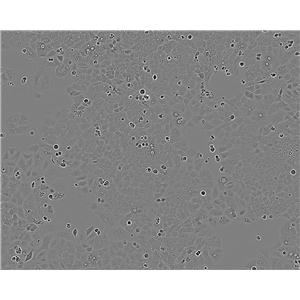 Hs 294T 人黑色素瘤细胞系