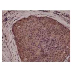 丝裂原活化蛋白激酶P38(抗体)