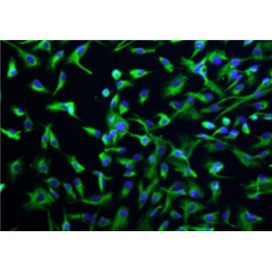 类胎牛血清LONSERA