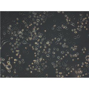 Hs 294T人黑色素瘤复苏细胞(附STR鉴定报告)