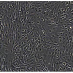 人胰腺癌相关成纤维细胞永生化