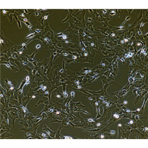 人前列腺成纤维原代细胞