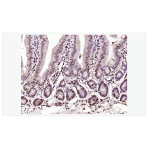 Anti-BLM antibody  -Bloom综合征相关蛋白抗体