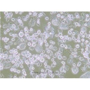 CCD-18Co正常人结肠组织细胞