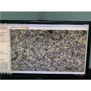 人喉表皮样癌细胞HEp-2