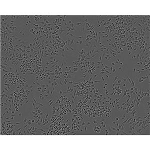 U251人胶质瘤细胞实验室|已有STR图谱