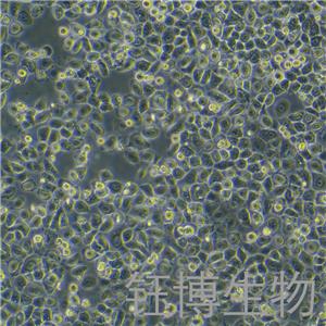 PC-9（人肺癌细胞）YB-71668HC