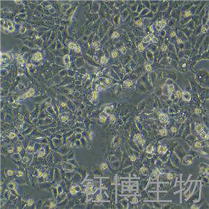 HT-1376（人膀胱癌细胞）YB-71672HC