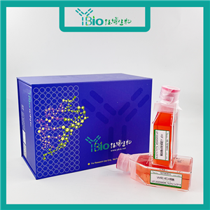 Lu-139（人小细胞肺癌细胞）YB-75972HC