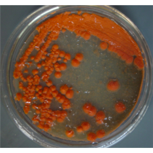 Spongiibacter Marinus