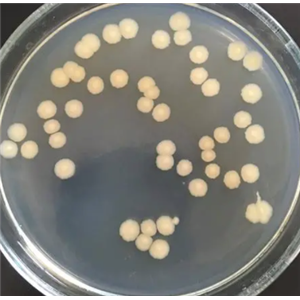 Legionella Israelensis