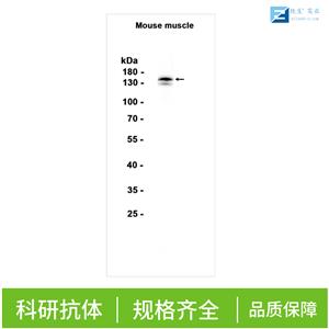 血管内皮细胞生长因子受体3抗体