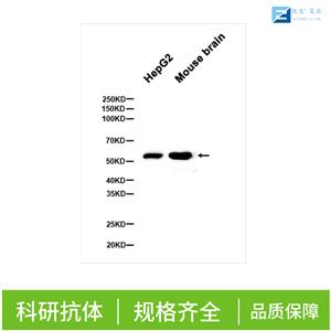 血管生成素受体2抗体