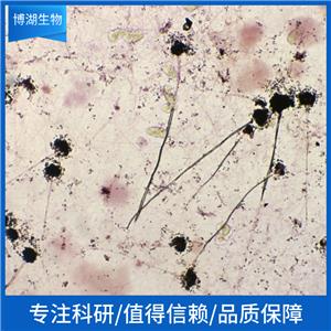 B16-F1 小鼠黑色素瘤细胞