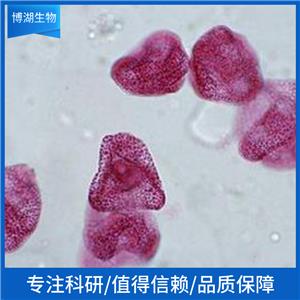 EO771小鼠髓样乳腺癌细胞